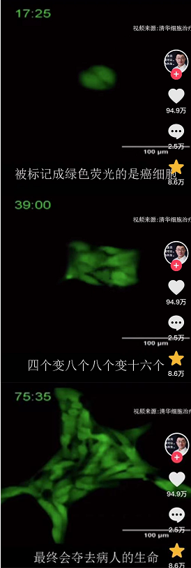 癌细胞变成肿瘤，究竟有多快？很多人患癌后也没明白