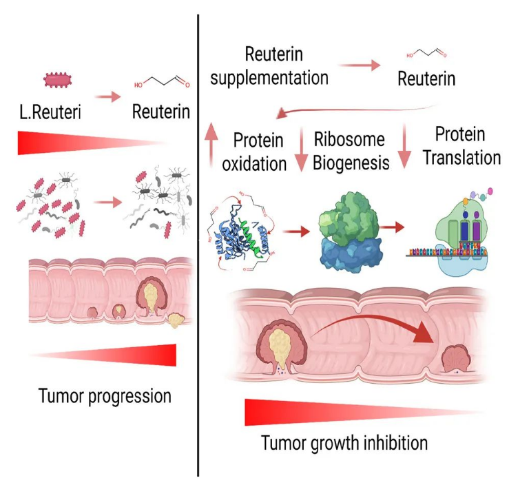 Cancer Cell：肠道菌群立功，通过代谢物罗伊氏菌素抑制结直肠癌