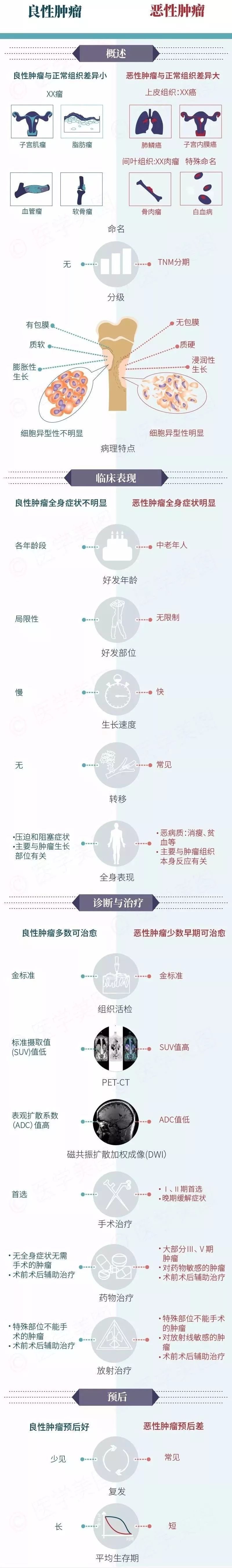 如何区分良性肿瘤与恶性肿瘤？